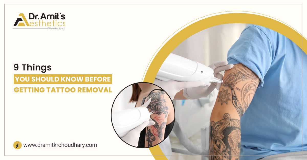 9 Things You Should Know Before Getting Tattoo Removal
