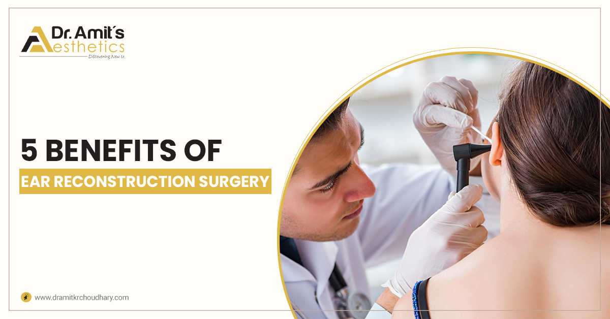 5 Benefits Of Ear Reconstruction Surgery