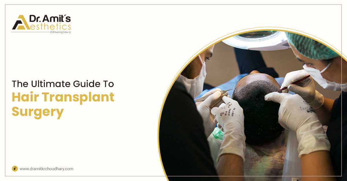 The Ultimate Guide To Hair Transplant Surgery