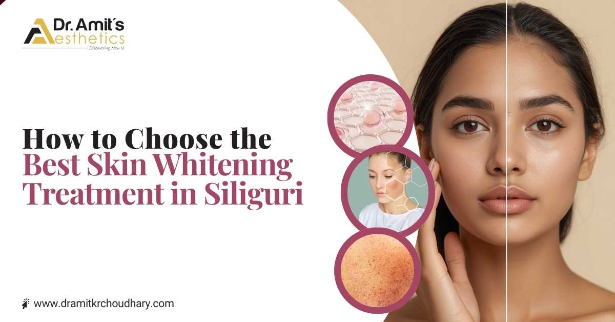How to choose the best skin whitening treatment