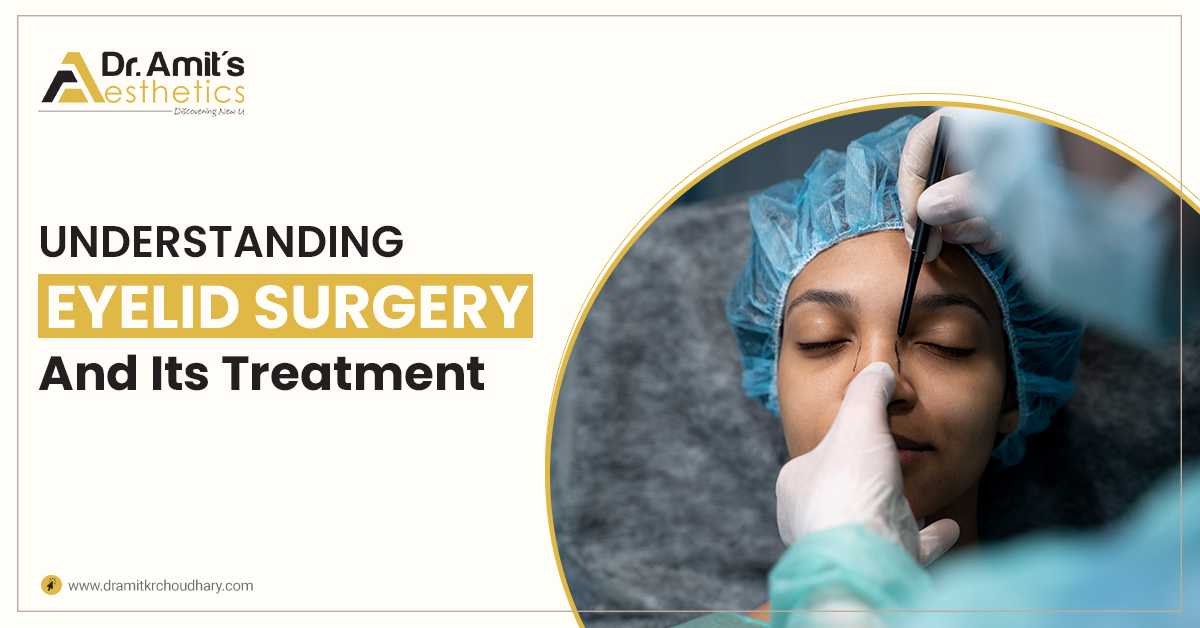 Understanding Eyelid Surgery & Its Treatment