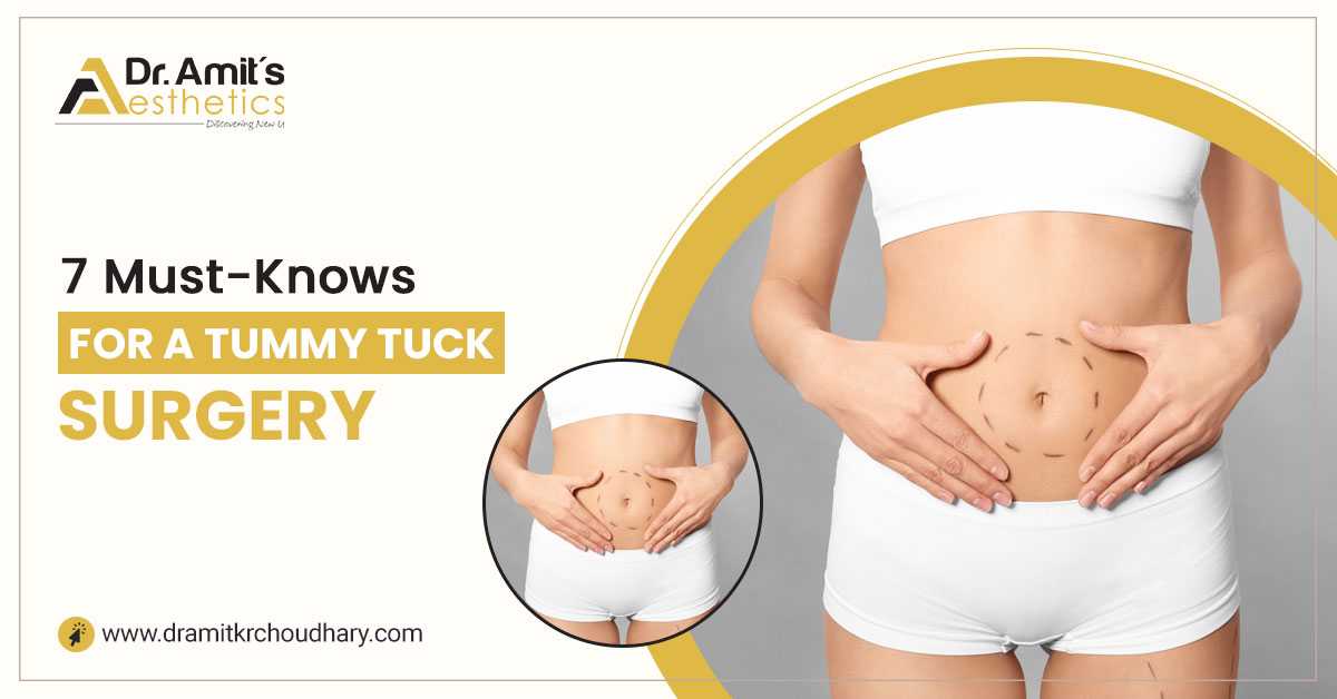 7 Must-Knows For A Tummy Tuck Surgery