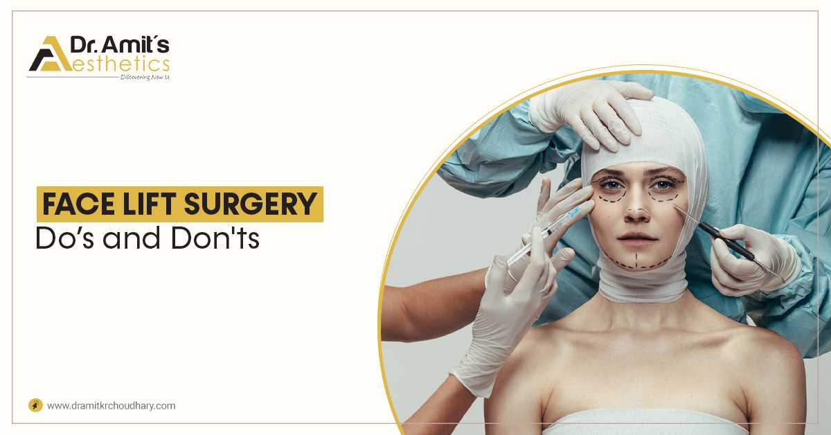 Face Lift Surgery - Do’s and Don'ts