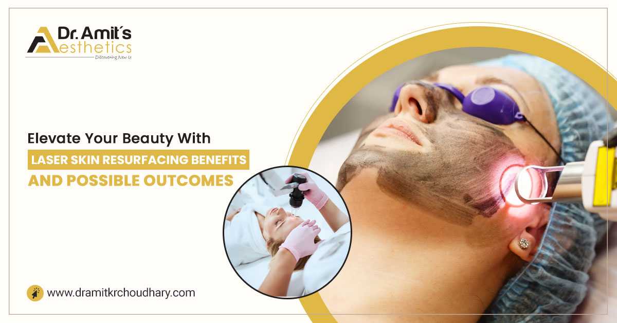 Elevate Your Beauty with Laser Skin Resurfacing: Benefits and Possible Outcomes