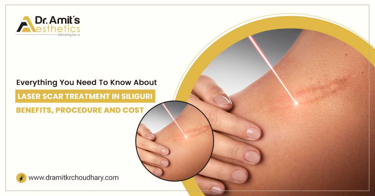 Everything You Need to Know About Laser Scar Treatment in Siliguri: Benefits, Procedure, and Cost