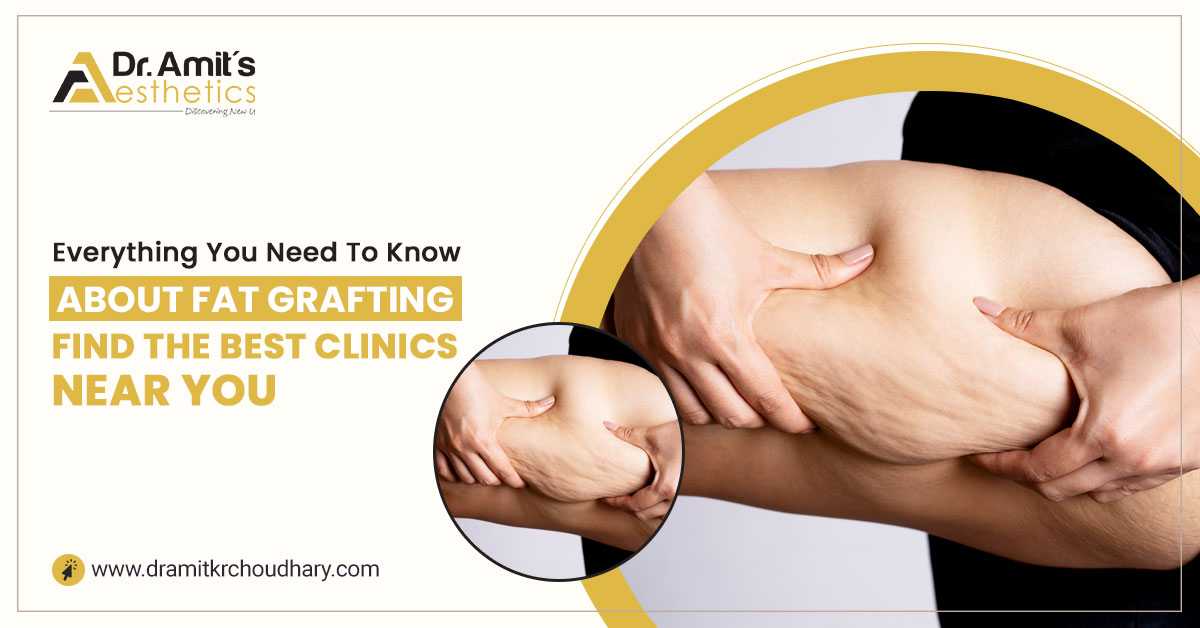 Everything You Need to Know About Fat Grafting: Find the Best Clinics Near You