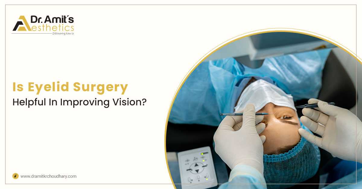 Is Eyelid Surgery Helpful In Improving Vision?