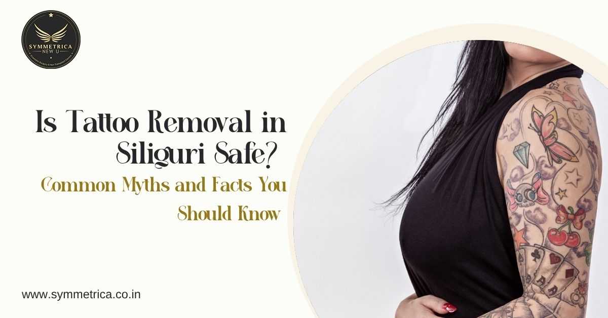 Is Tattoo Removal in Siliguri Safe? Common Myths and Facts You Should Know