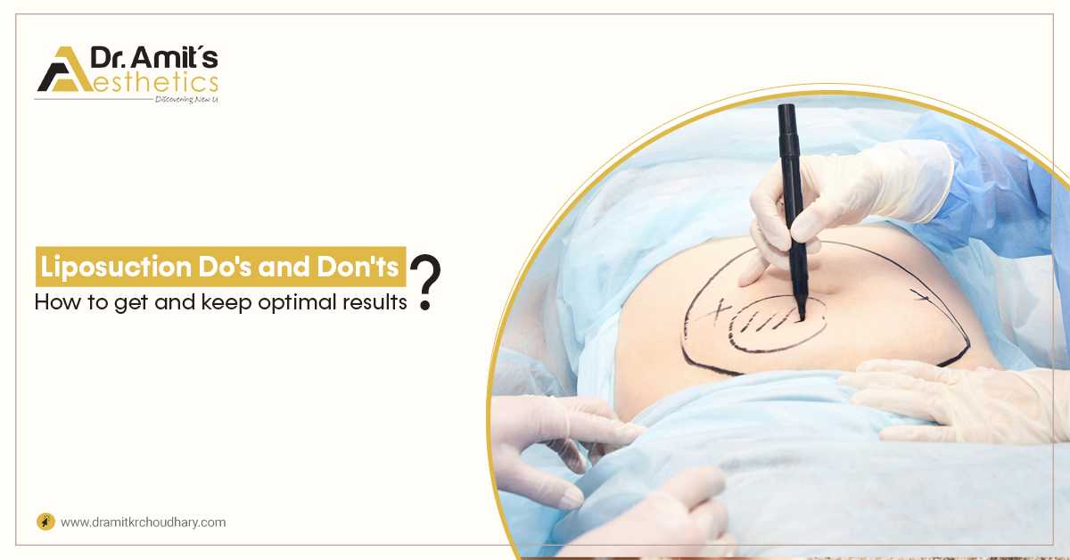 Liposuction Do's and Don'ts - How to get and keep optimal results