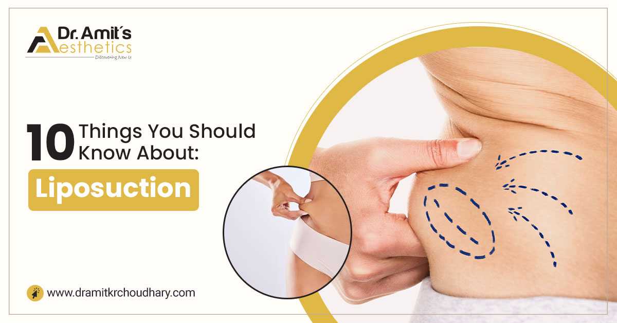 10 Things You Should Know About Liposuction