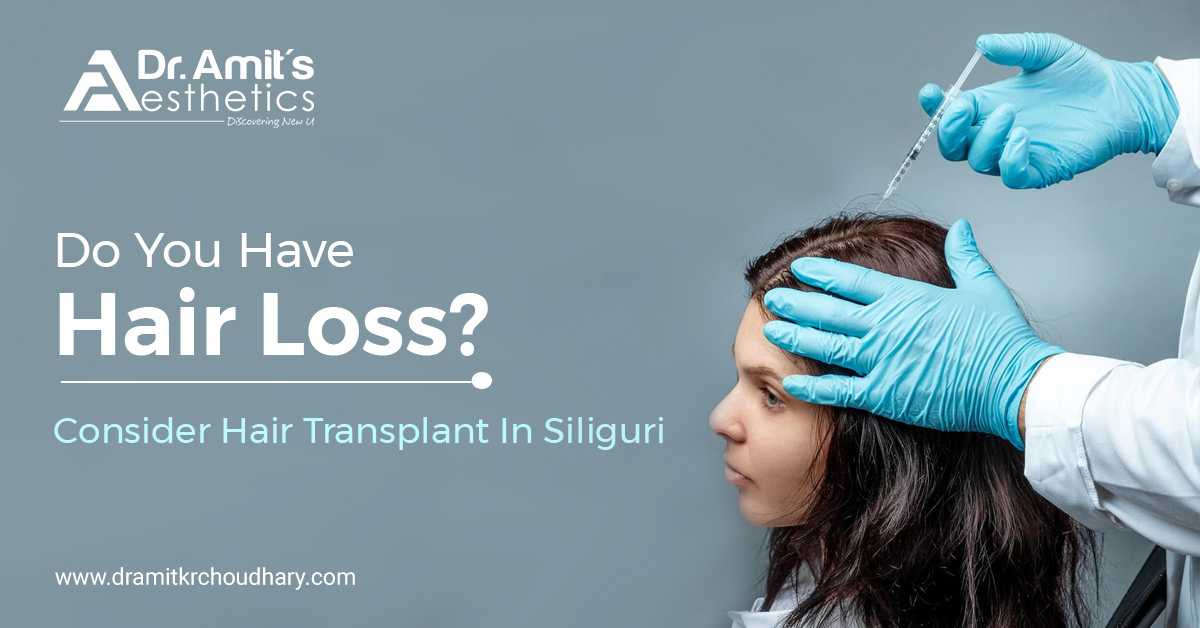 Do You Have Hair Loss? Consider Hair Transplant In Siliguri