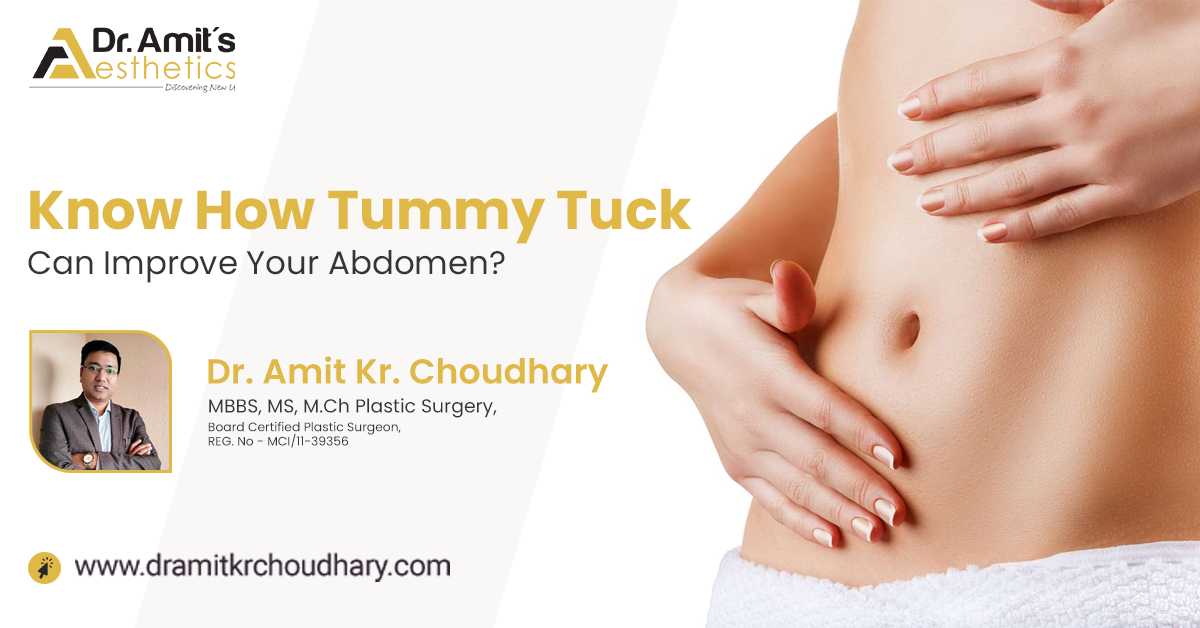 Visit A Plastic Surgeon To Know How Tummy Tuck Can Improve Your Abdomen