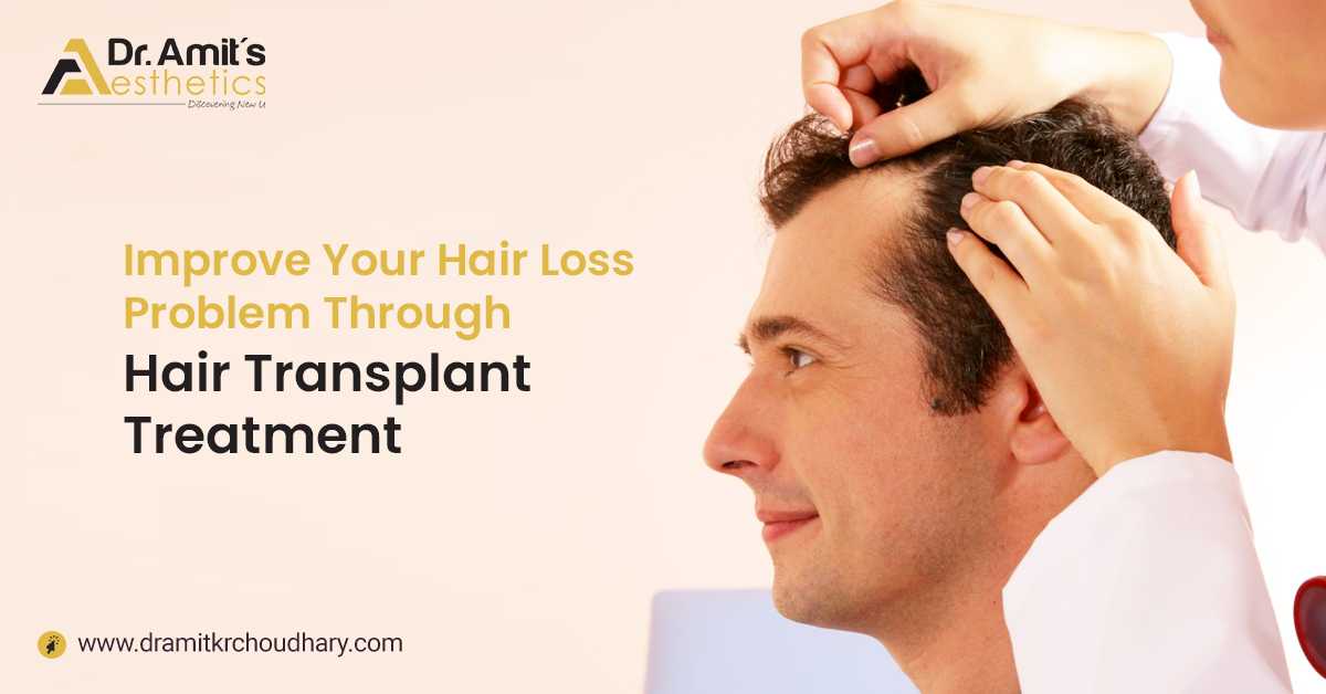 Improve Your Hair Loss Problem Through Hair Transplant Treatment