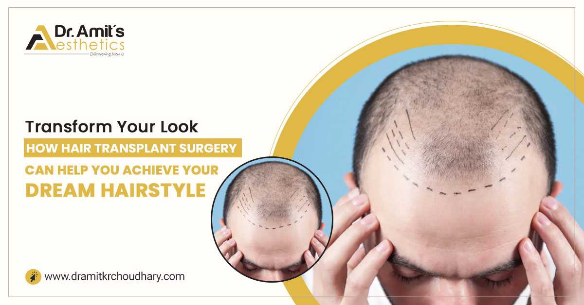 Transform Your Look: How Hair Transplant Surgery Can Help You Achieve Your Dream Hairstyle