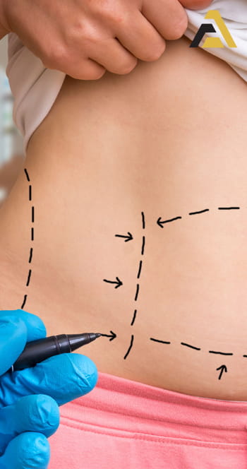 Body Contouring