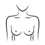 Breast Surgery