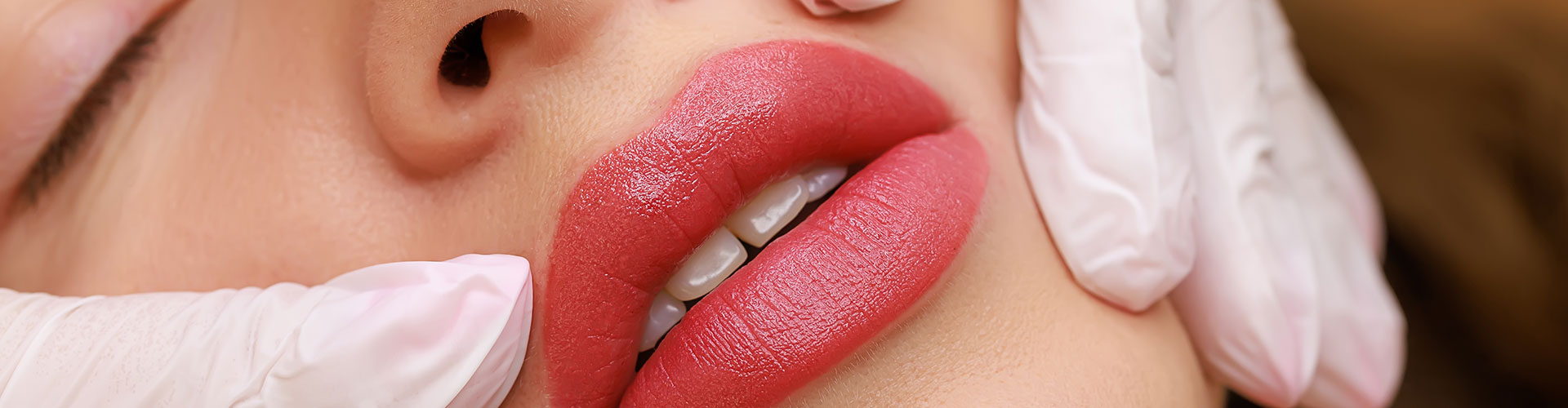 Lip Augmentation in Siliguri