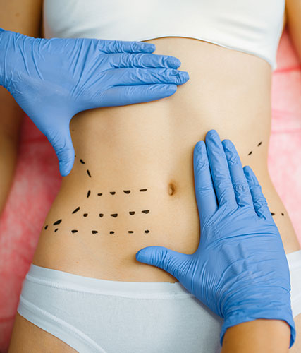 Limitations of tummy tuck surgery