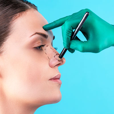 Rhinoplasty