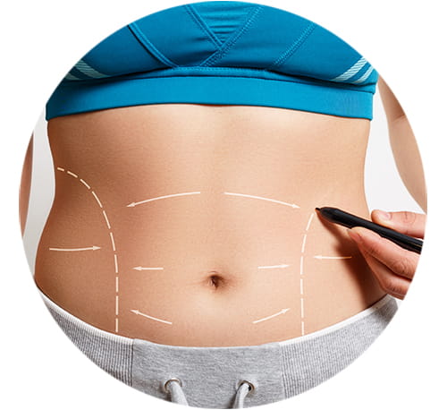 Why people undergo Tummy Tuck Surgery